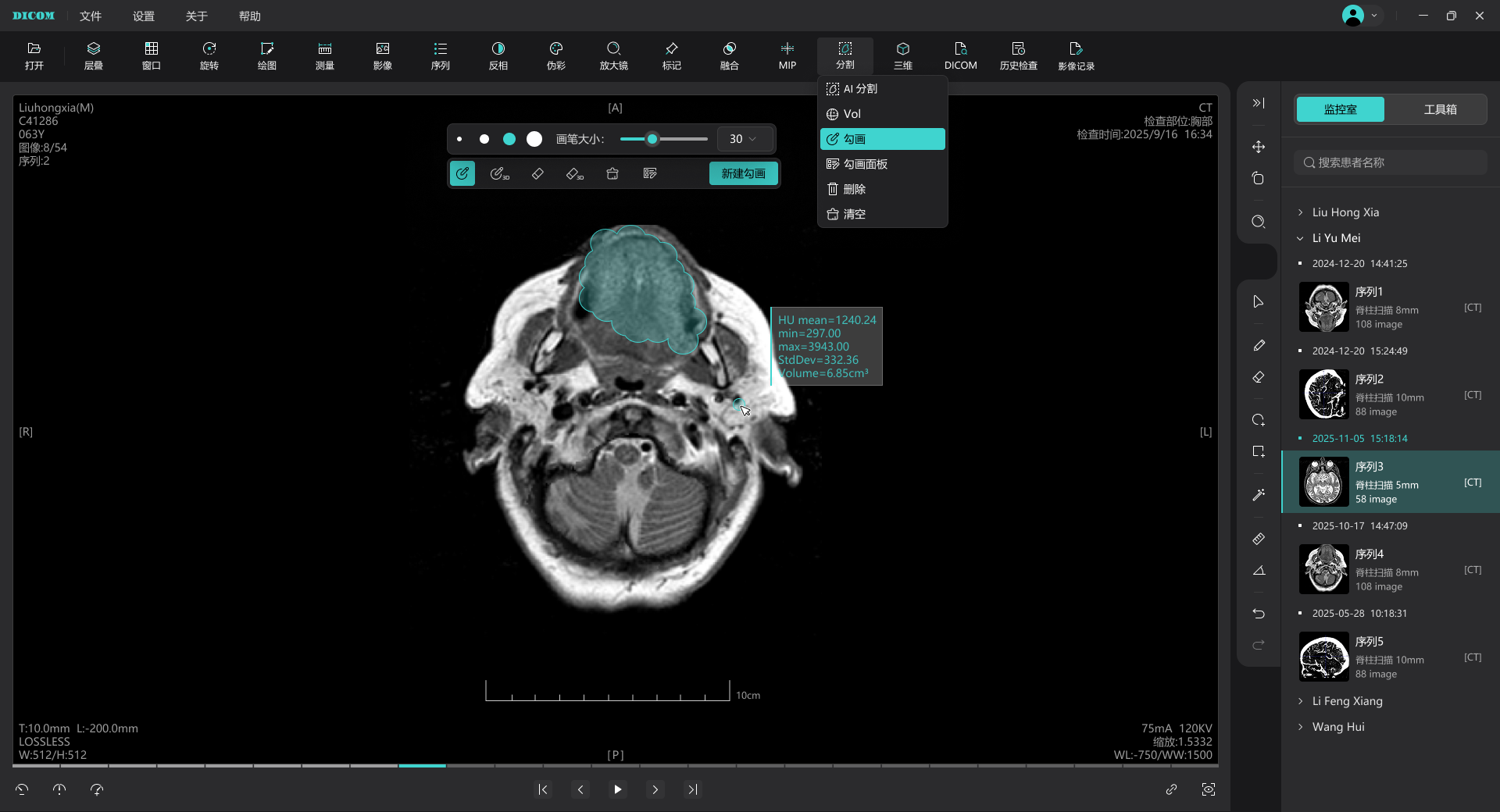医学影像AI分割UI设计
